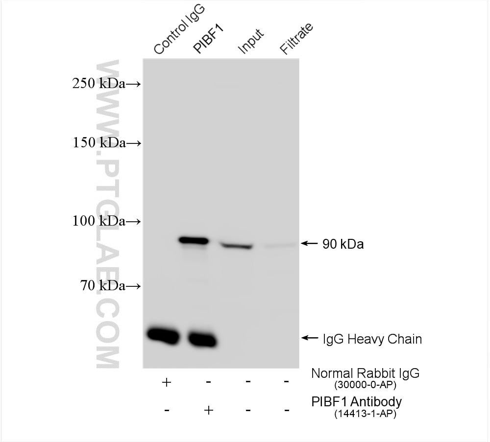 Immunoprecipitation (IP) experiment of HEK-293 cells using PIBF1 Polyclonal antibody (14413-1-AP)