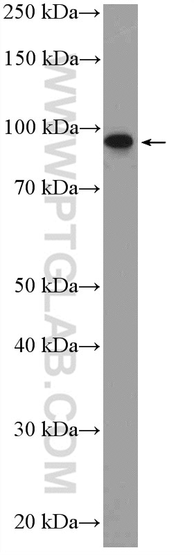 Western Blot (WB) analysis of HeLa cells using PIBF1 Polyclonal antibody (14413-1-AP)