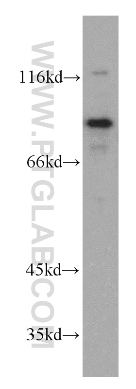 Western Blot (WB) analysis of MCF-7 cells using PIBF1 Polyclonal antibody (14413-1-AP)