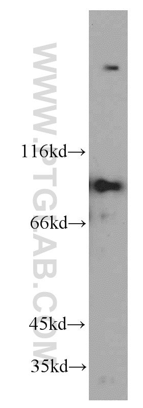 Western Blot (WB) analysis of K-562 cells using PIBF1 Polyclonal antibody (14413-1-AP)