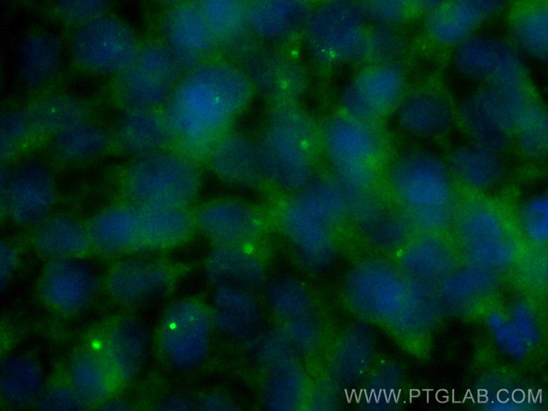 Immunofluorescence (IF) / fluorescent staining of HEK-293 cells using CoraLite® Plus 488-conjugated PIBF1 Polyclonal ant (CL488-14413)