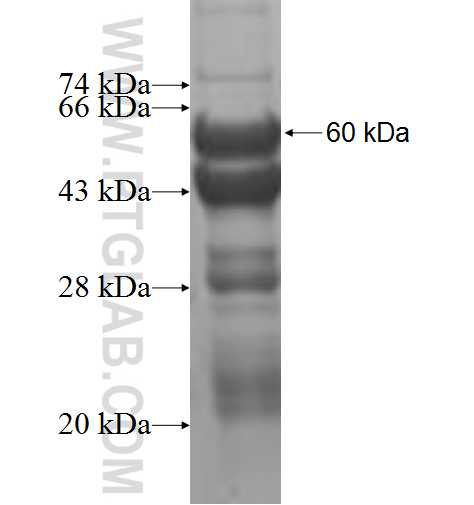 PIBF1 fusion protein Ag5755 SDS-PAGE