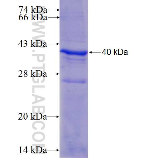 PIBF1 fusion protein Ag5871 SDS-PAGE