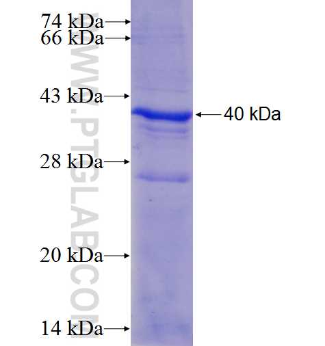 PIBF1 fusion protein Ag5871 SDS-PAGE PIBF1 fusion protein Ag5871 SDS-PAGE