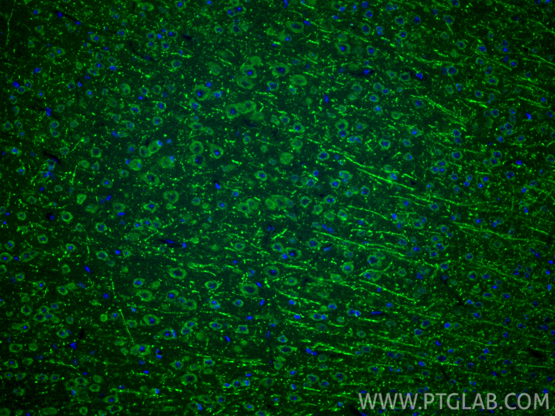 Immunofluorescence (IF) / fluorescent staining of mouse brain tissue using PICALM Polyclonal antibody (28554-1-AP)