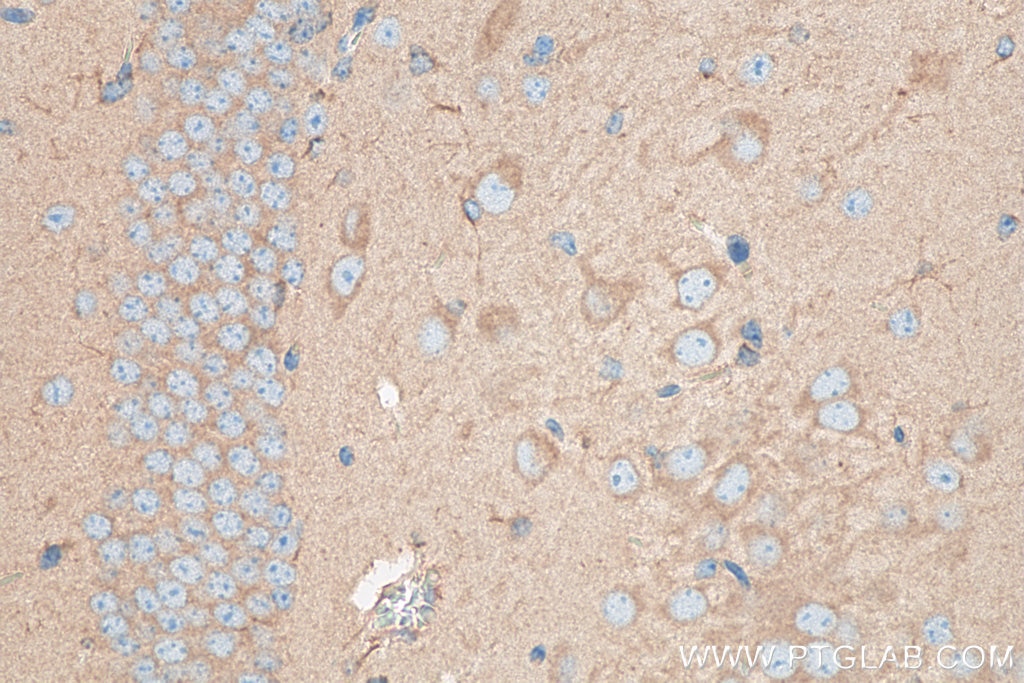 Immunohistochemistry (IHC) staining of mouse brain tissue using PICALM Polyclonal antibody (28554-1-AP)
