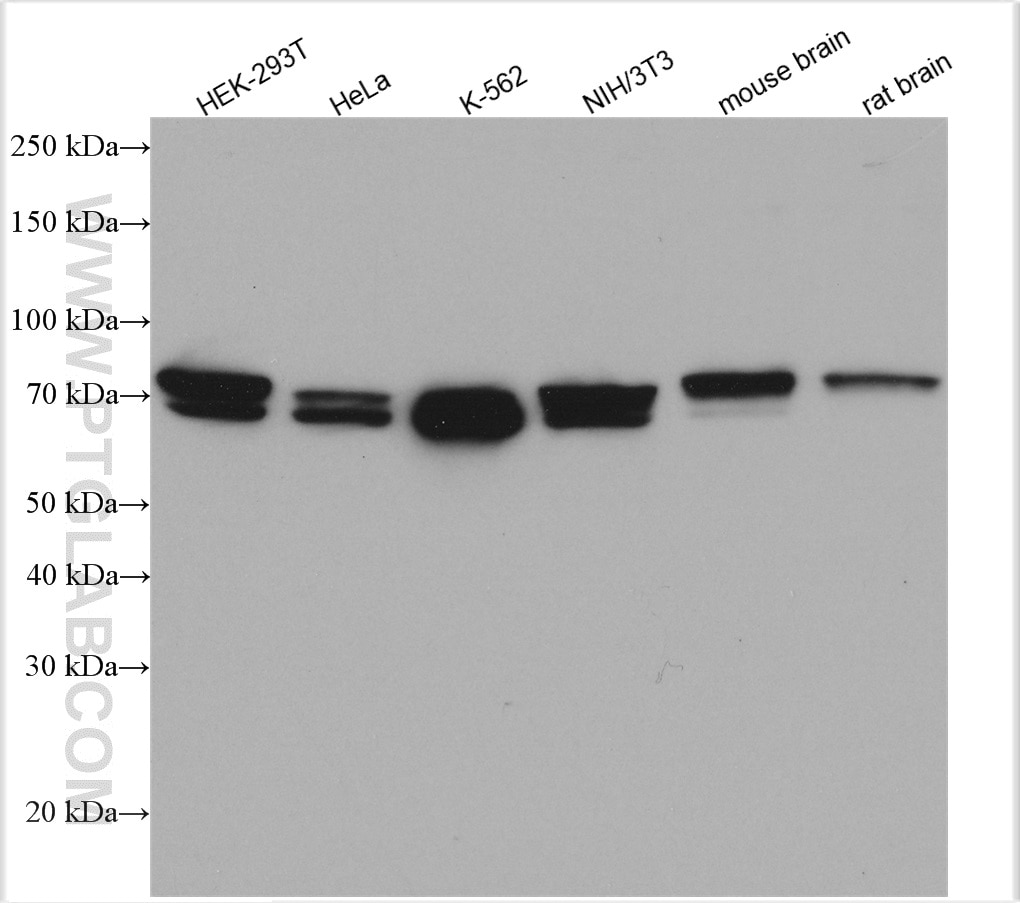 Western Blot (WB) analysis of various lysates using PICALM Polyclonal antibody (28554-1-AP)