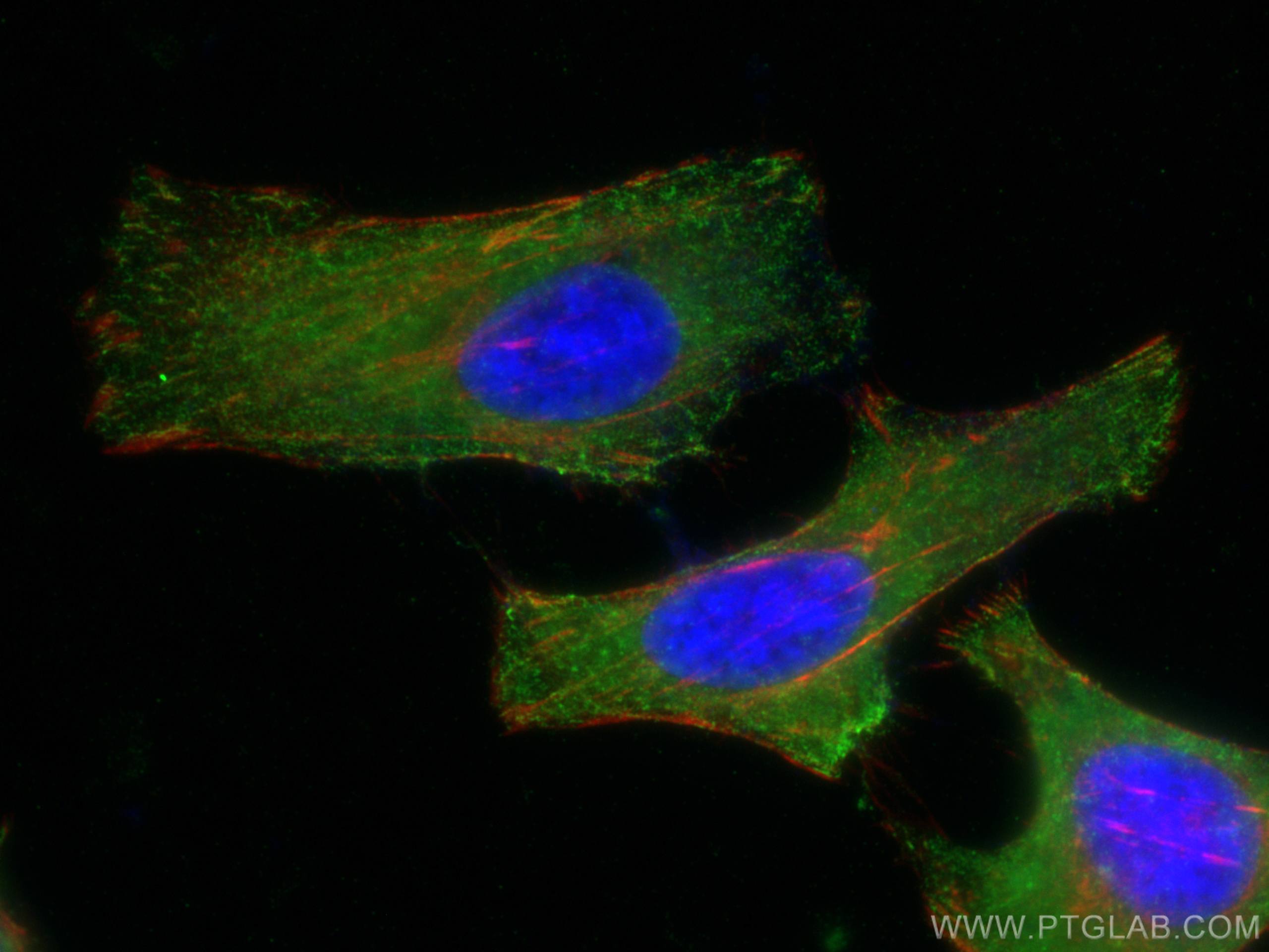 Immunofluorescence (IF) / fluorescent staining of HeLa cells using PICALM Monoclonal antibody (67564-1-Ig)