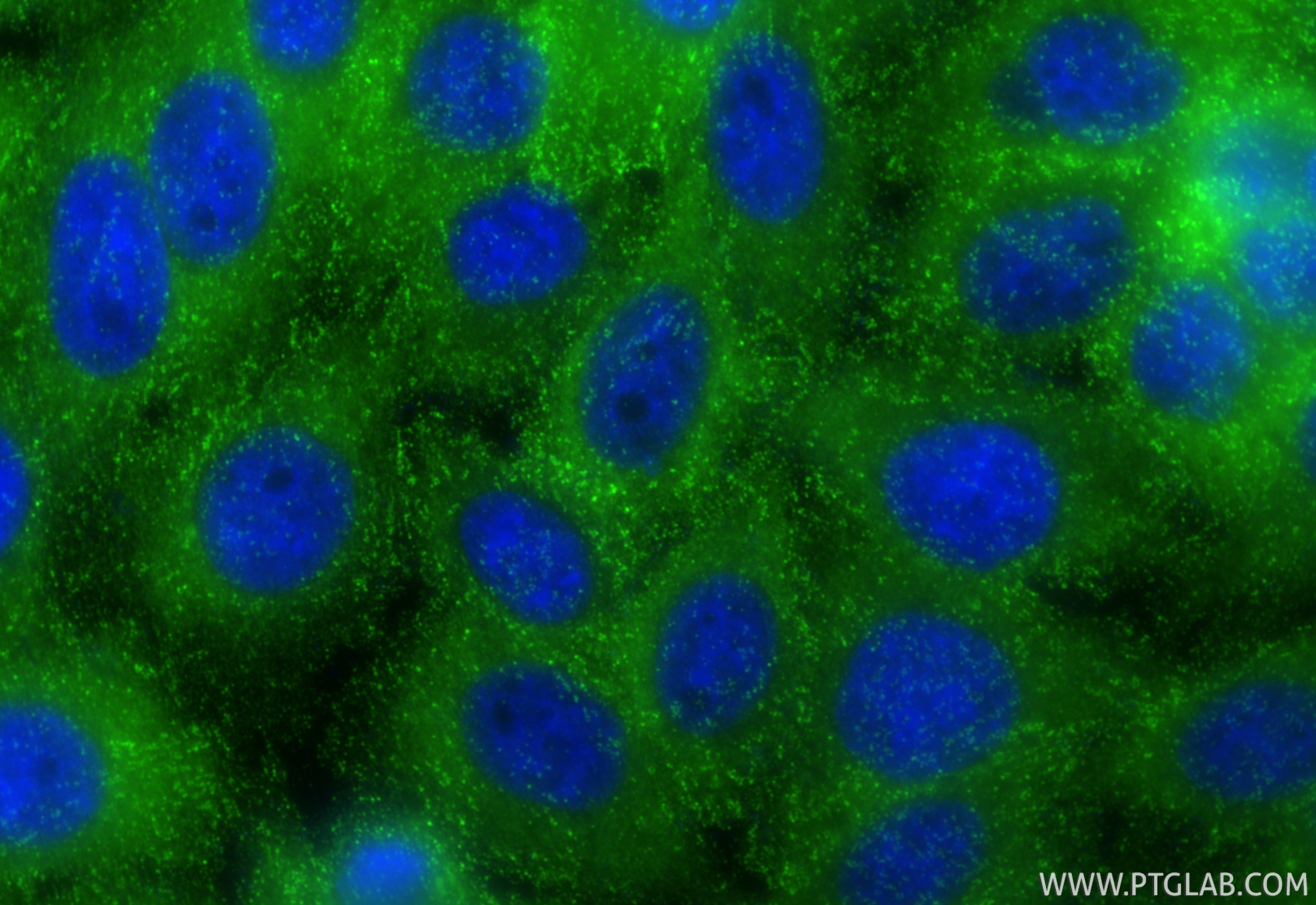 Immunofluorescence (IF) / fluorescent staining of HepG2 cells using PICALM Monoclonal antibody (67564-1-Ig)