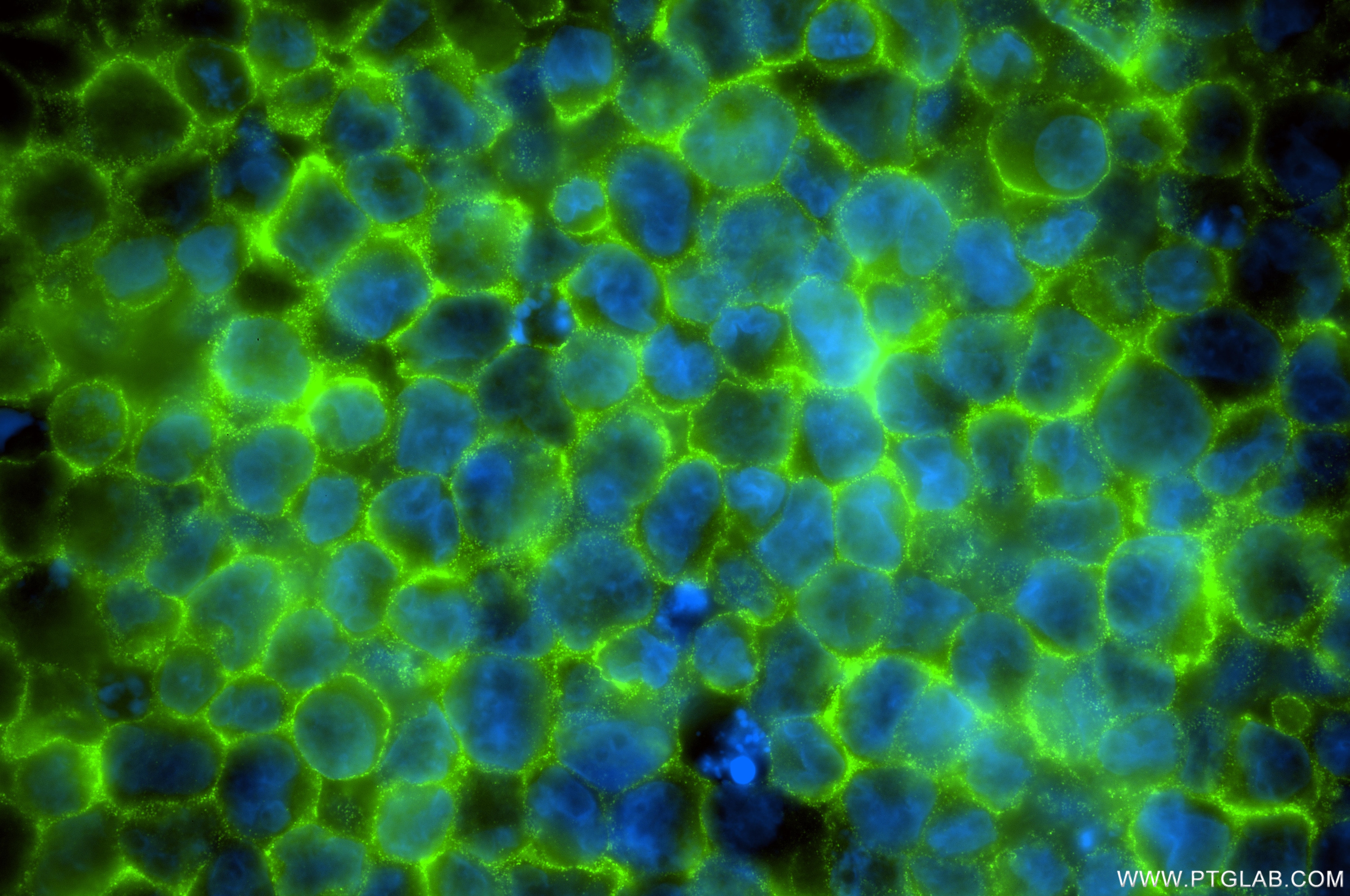 Immunofluorescence (IF) / fluorescent staining of K-562 cells using PICALM Recombinant monoclonal antibody (87344-1-RR)