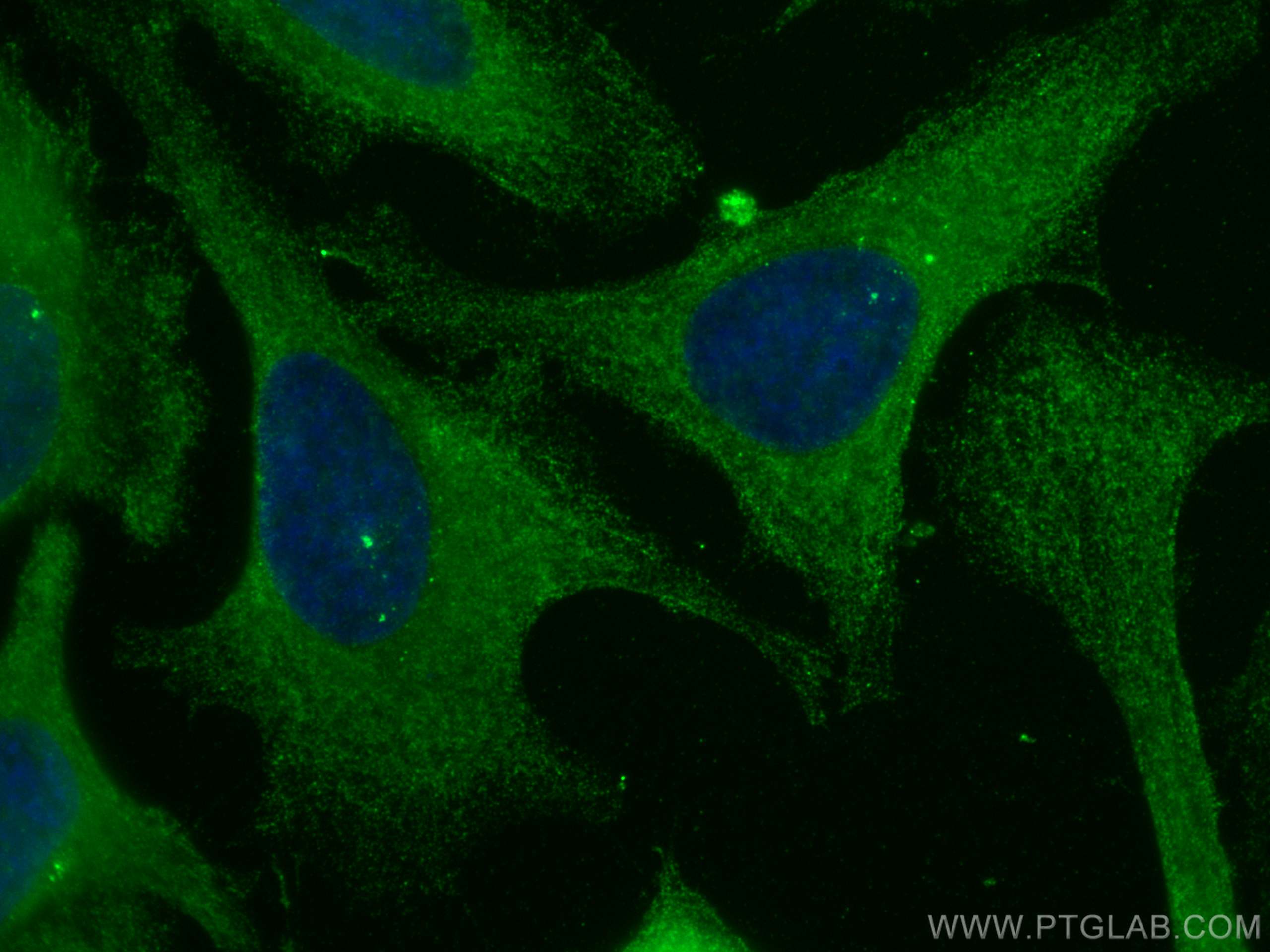 Immunofluorescence (IF) / fluorescent staining of HeLa cells using CoraLite® Plus 488-conjugated PICALM Monoclonal an (CL488-67564)