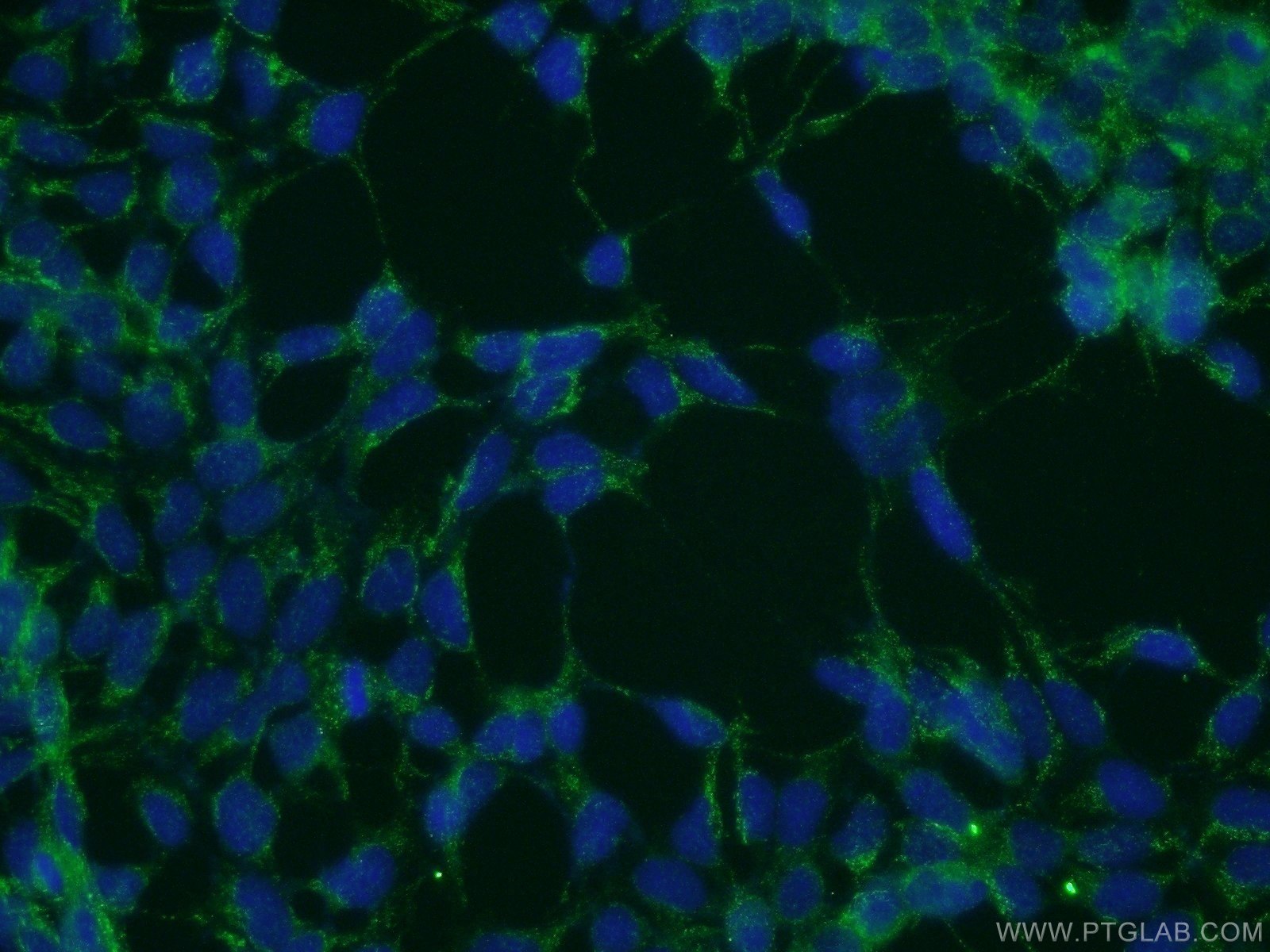 Immunofluorescence (IF) / fluorescent staining of HEK-293 cells using PICK1 Polyclonal antibody (10983-2-AP)