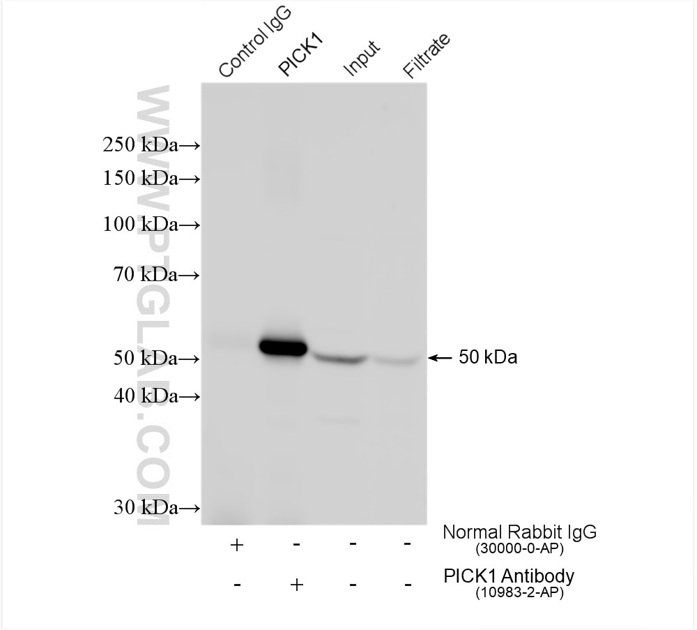 IP experiment of mouse brain using 10983-2-AP