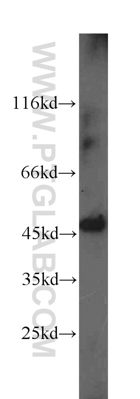 PICK1 Polyclonal antibody