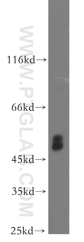 Western Blot (WB) analysis of human brain tissue using PICK1 Polyclonal antibody (10983-2-AP)
