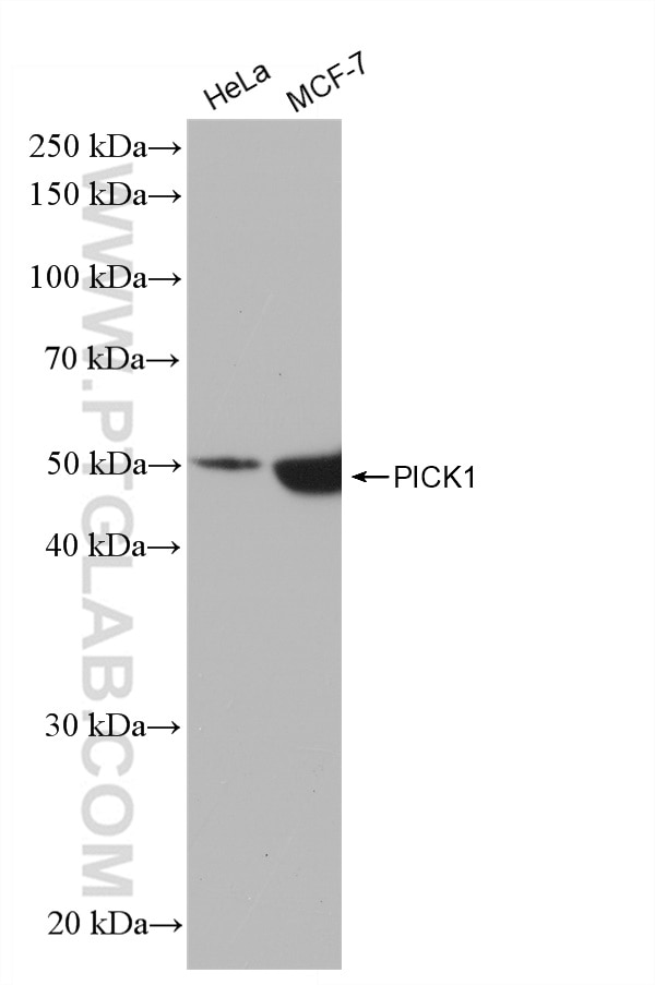 Western Blot (WB) analysis of various lysates using PICK1 Recombinant antibody (82919-1-RR)