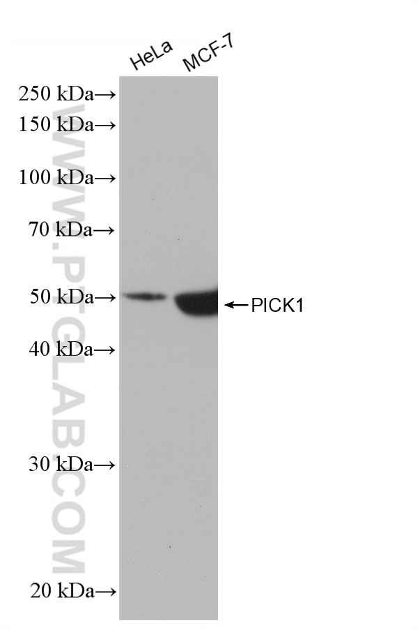 WB analysis using 82919-1-RR