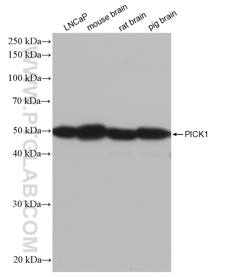 Western Blot (WB) analysis of various lysates using PICK1 Recombinant antibody (82919-1-RR)