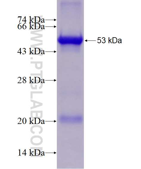 PICK1 fusion protein Ag28609 SDS-PAGE