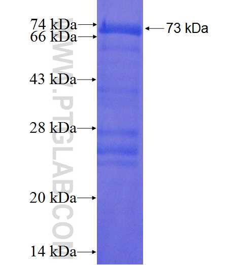PICK1 fusion protein Ag1443 SDS-PAGE