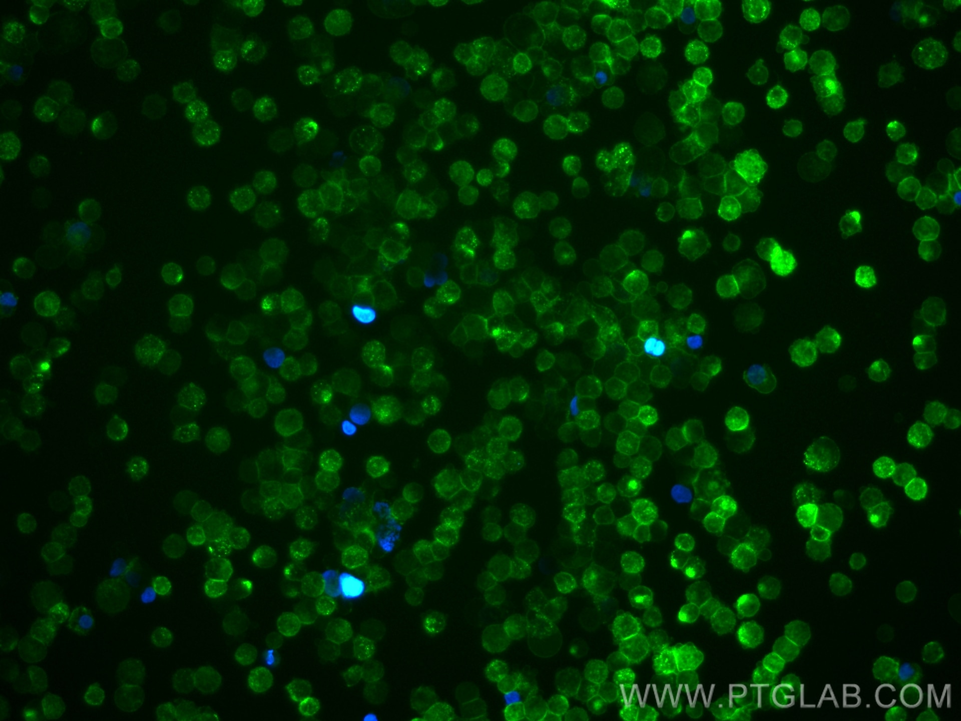 Immunofluorescence (IF) / fluorescent staining of THP-1 cells using Piezo1 (extracellular domain) Polyclonal antibody (28511-1-AP)