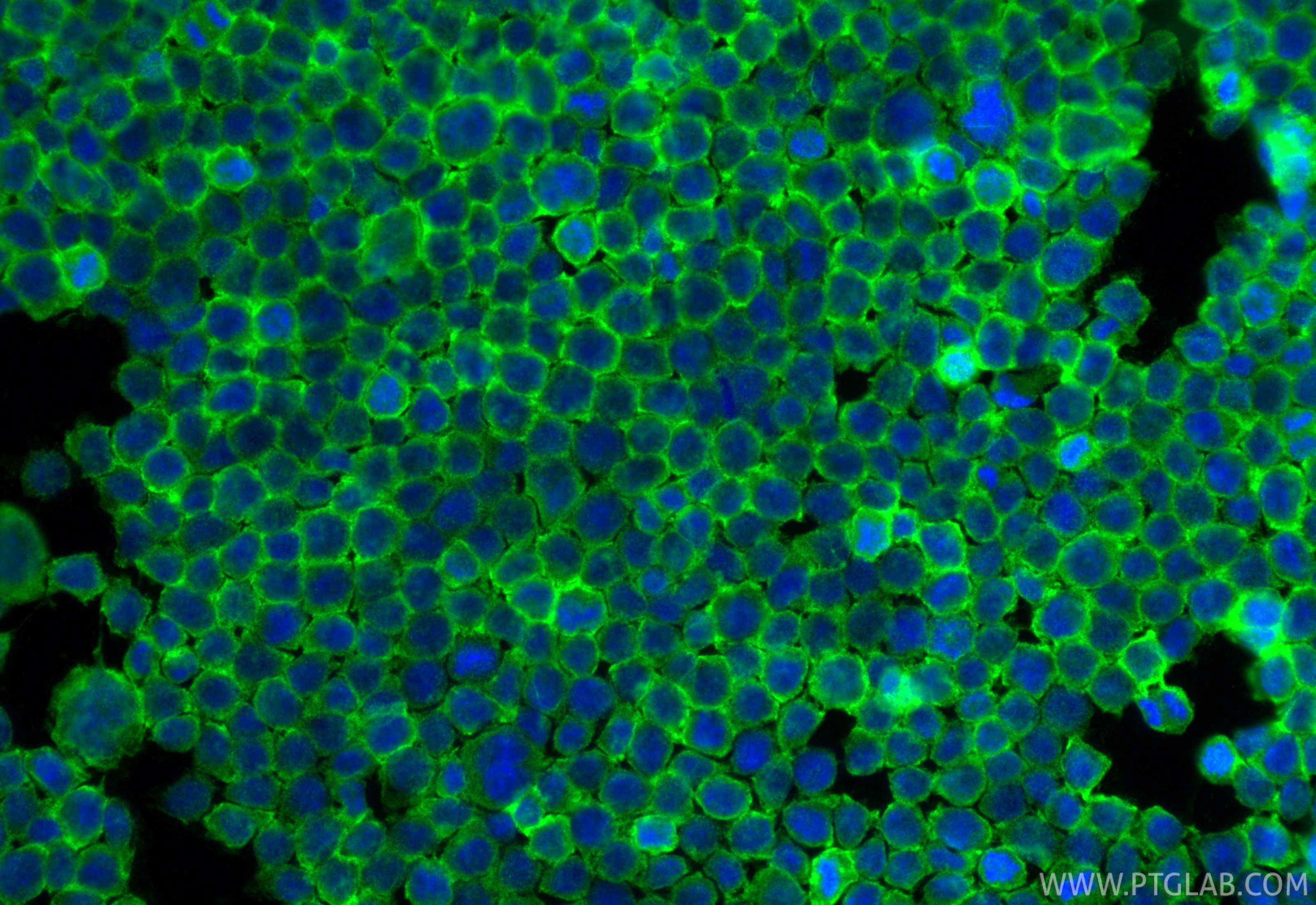 Immunofluorescence (IF) / fluorescent staining of THP-1 cells using Piezo1 (extracellular domain) Polyclonal antibody (28511-1-AP)