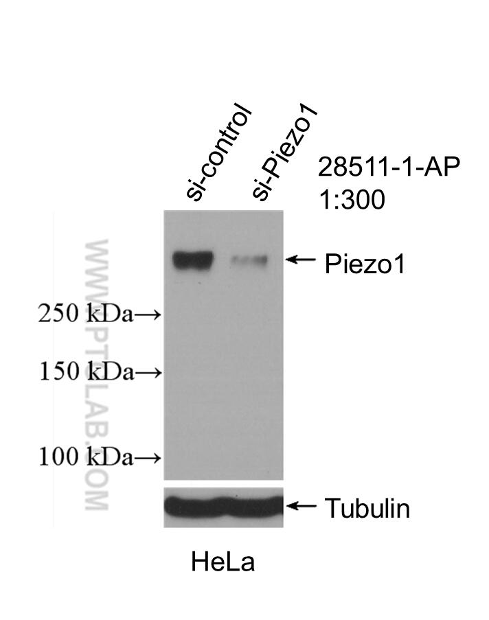 Piezo1 (extracellular domain)