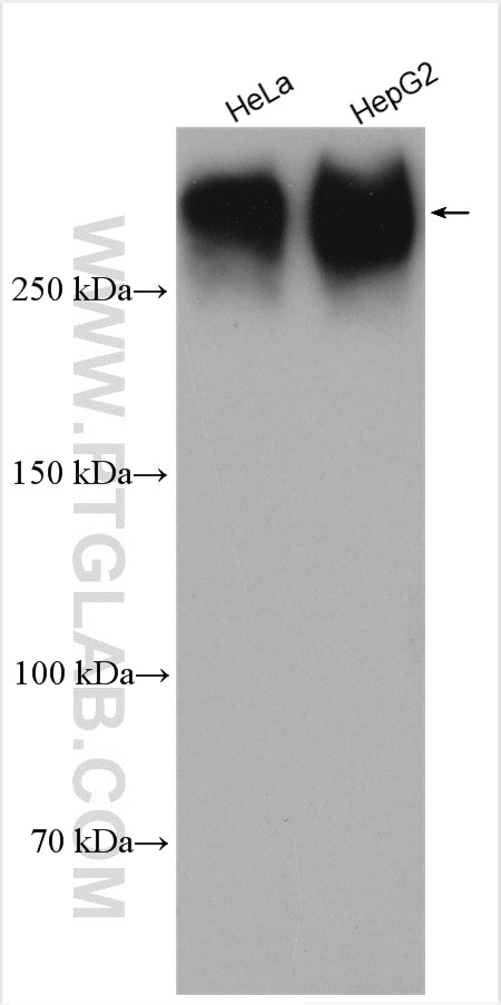 Western Blot (WB) analysis of various lysates using Piezo1 (extracellular domain) Polyclonal antibody (28511-1-AP)