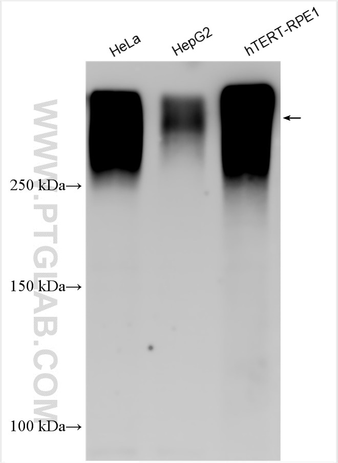 Western Blot (WB) analysis of various lysates using Piezo1 (extracellular domain) Polyclonal antibody (28511-1-AP)