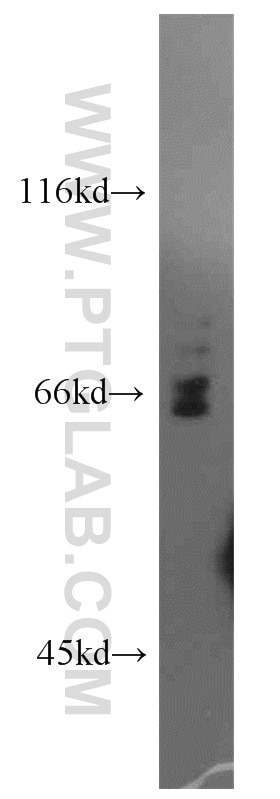 Western Blot (WB) analysis of mouse thymus tissue using PIF1 Polyclonal antibody (19006-1-AP)