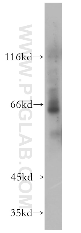 Western Blot (WB) analysis of mouse thymus tissue using PIF1 Polyclonal antibody (19006-1-AP)