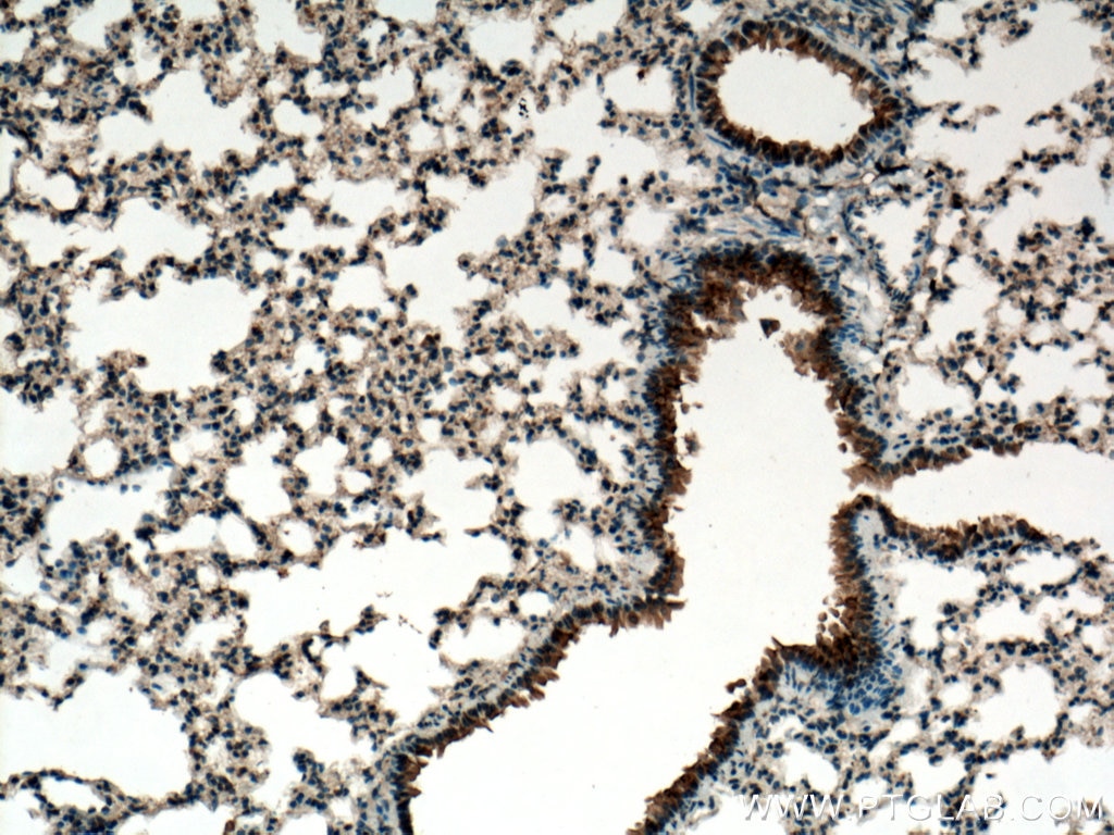 Immunohistochemistry (IHC) staining of mouse lung tissue using PIGA Polyclonal antibody (13679-1-AP)