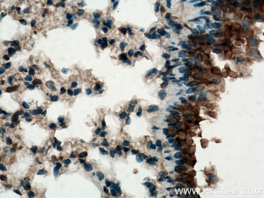 Immunohistochemistry (IHC) staining of mouse lung tissue using PIGA Polyclonal antibody (13679-1-AP)