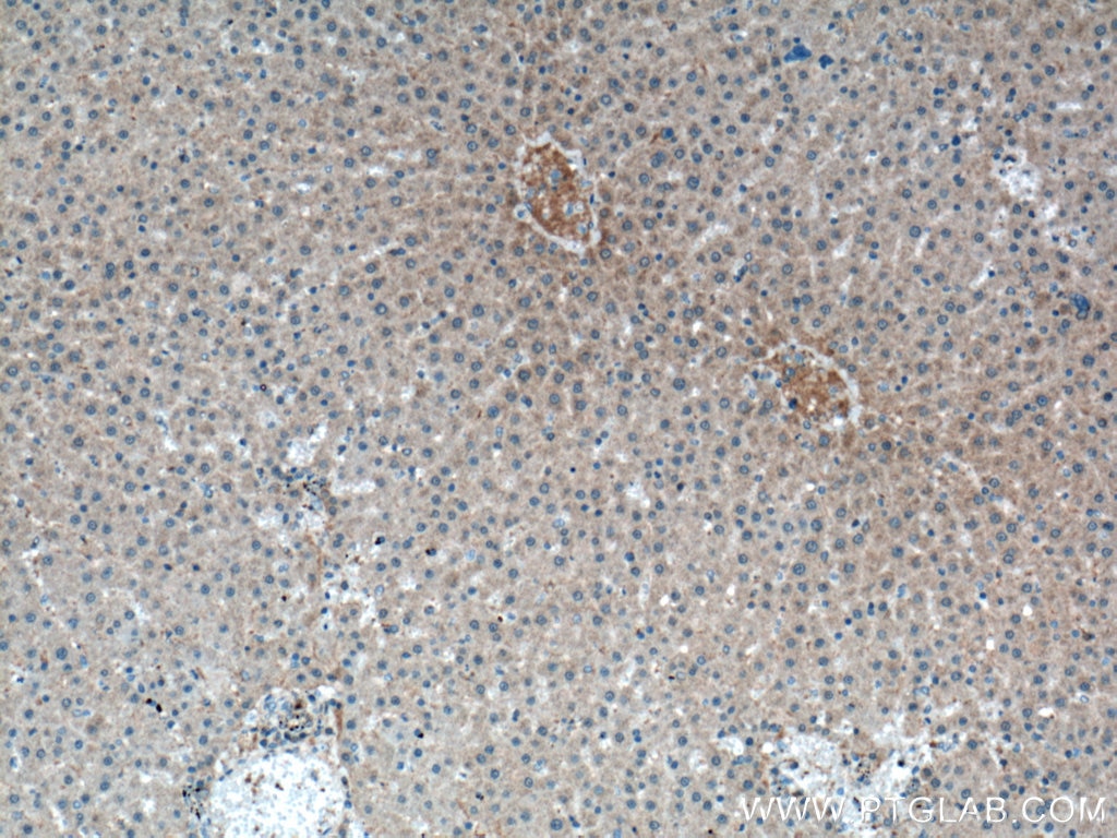 Immunohistochemistry (IHC) staining of rat liver tissue using PIGA Polyclonal antibody (13679-1-AP)