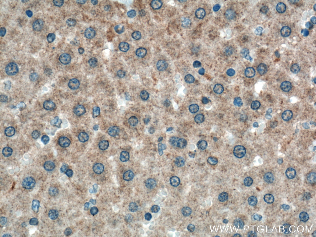 Immunohistochemistry (IHC) staining of rat liver tissue using PIGA Polyclonal antibody (13679-1-AP)