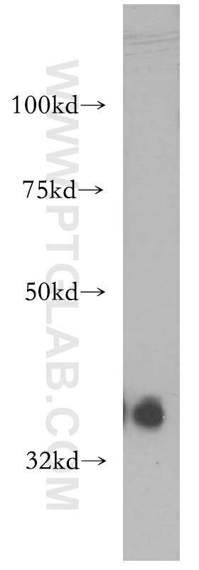 Western Blot (WB) analysis of HeLa cells using PIGA Polyclonal antibody (13679-1-AP)