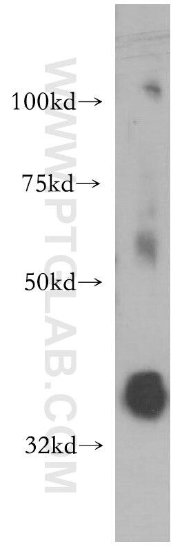 Western Blot (WB) analysis of HeLa cells using PIGA Polyclonal antibody (13679-1-AP)