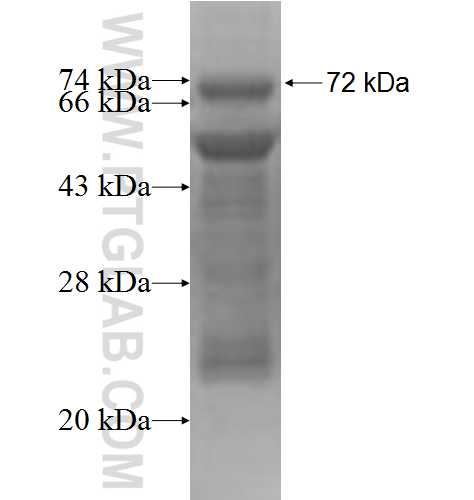 PIGA fusion protein Ag4530 SDS-PAGE