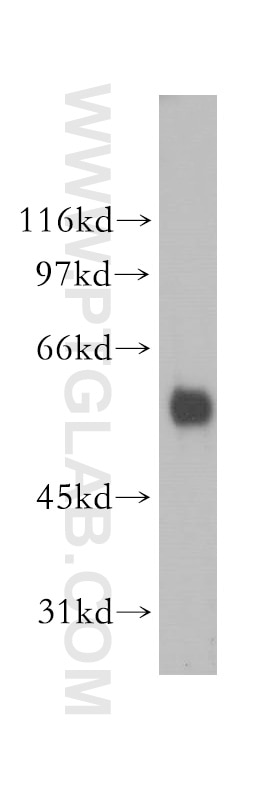 Western Blot (WB) analysis of Raji cells using PIGB Polyclonal antibody (12612-1-AP)