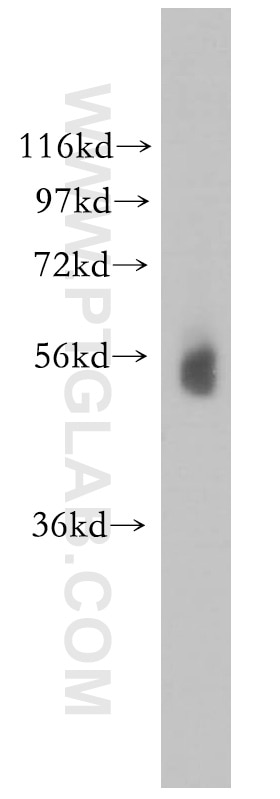 Western Blot (WB) analysis of mouse testis tissue using PIGB Polyclonal antibody (12612-1-AP)