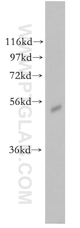 Western Blot (WB) analysis of human brain tissue using PIGB Polyclonal antibody (12612-1-AP)