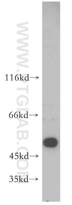 WB analysis of human liver using 12612-1-AP