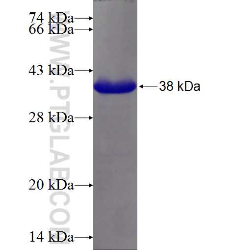 PIGG fusion protein Ag25160 SDS-PAGE