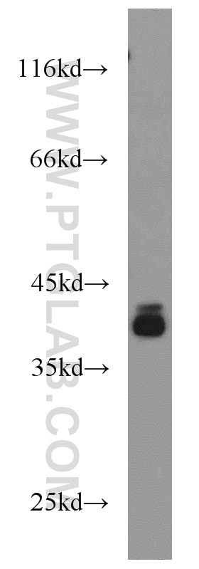 Western Blot (WB) analysis of HT-1080 cells using PIGK Polyclonal antibody (15151-1-AP)