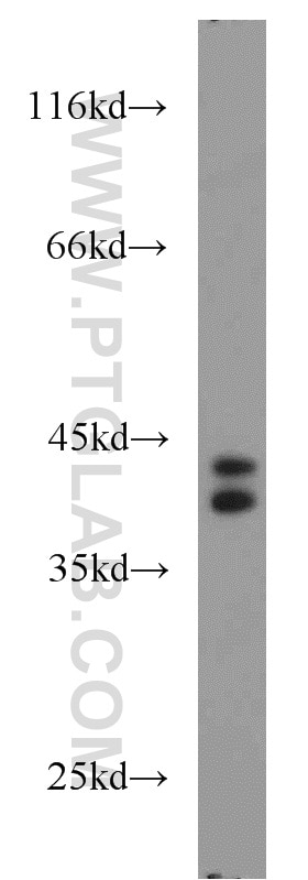 Western Blot (WB) analysis of SMMC-7721 cells using PIGK Polyclonal antibody (15151-1-AP)