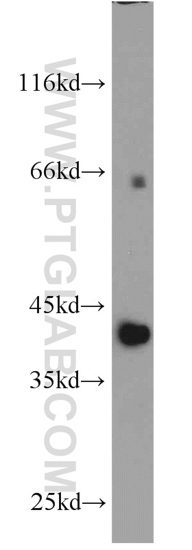 Western Blot (WB) analysis of HepG2 cells using PIGK Polyclonal antibody (15151-1-AP)