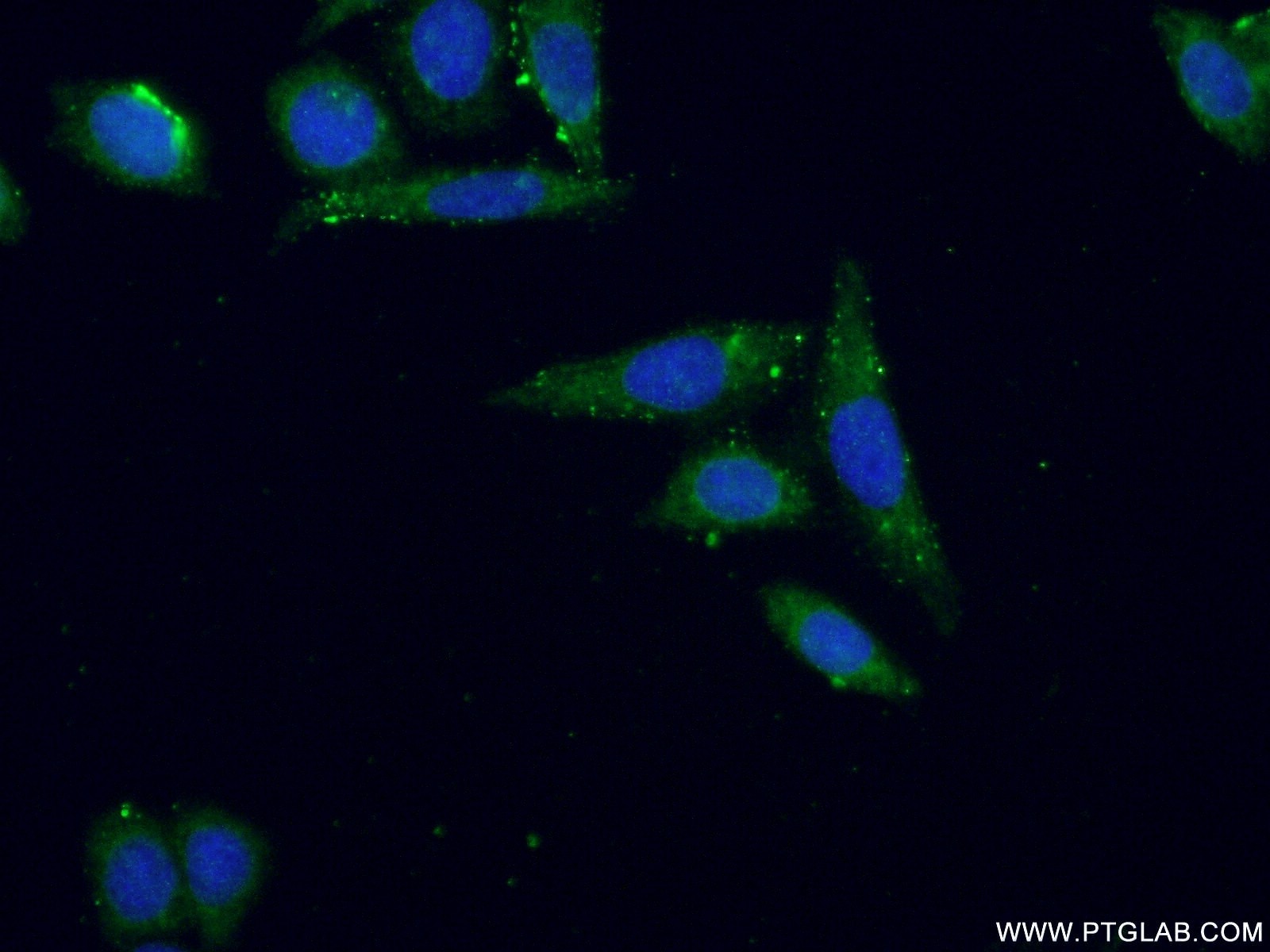 Immunofluorescence (IF) / fluorescent staining of HeLa cells using PIGM Polyclonal antibody (20421-1-AP)
