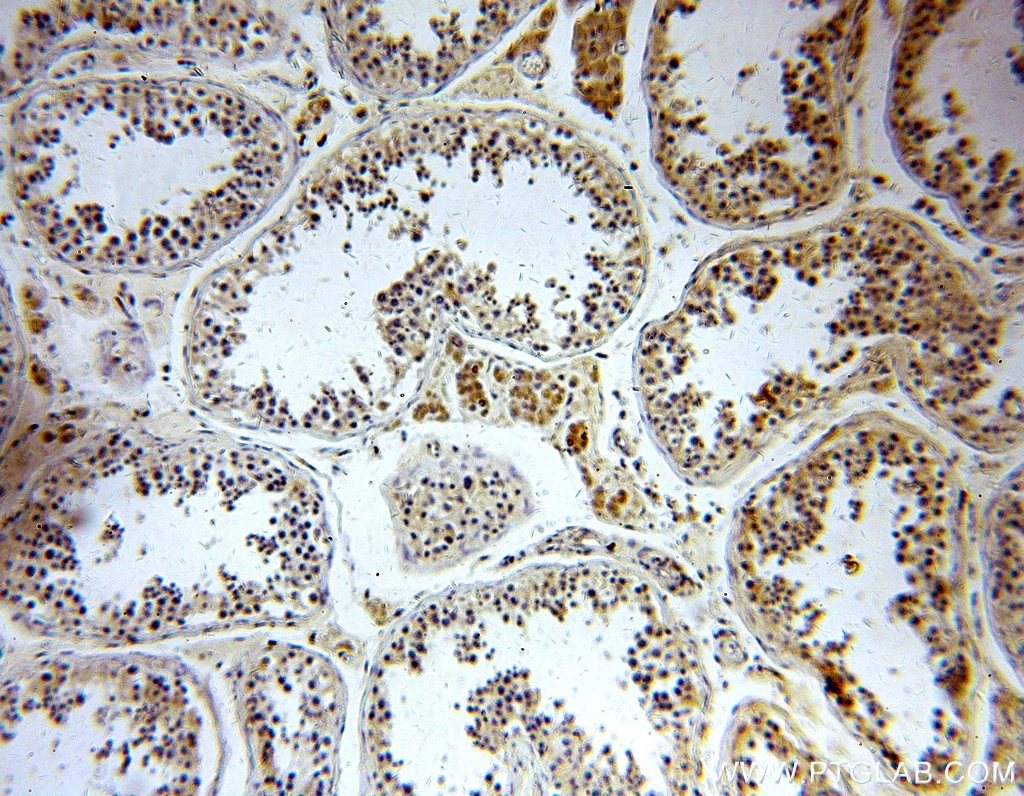 Immunohistochemistry (IHC) staining of human testis tissue using PIGM Polyclonal antibody (20421-1-AP)