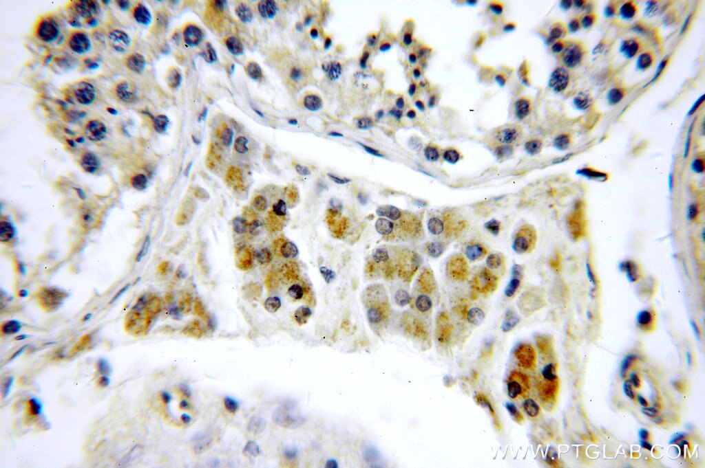 IHC staining of human testis using 20421-1-AP