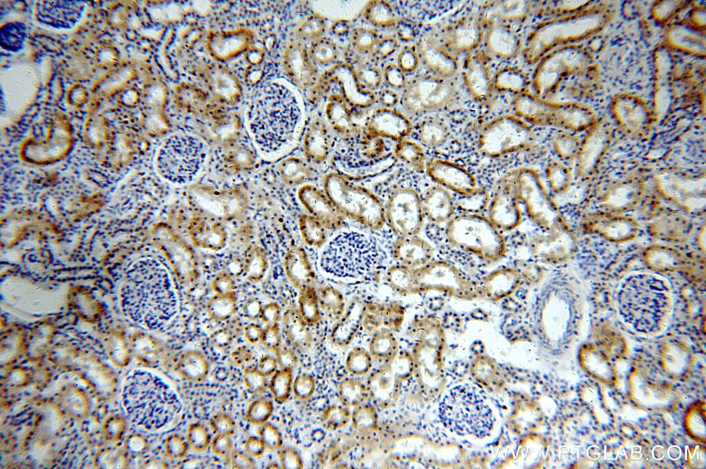 Immunohistochemistry (IHC) staining of human kidney tissue using PIGM Polyclonal antibody (20421-1-AP)